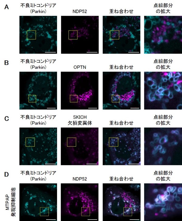 オートファジーによる新たな不良ミトコンドリア認識機構を発見 順天堂大学医学部 大学院医学研究科